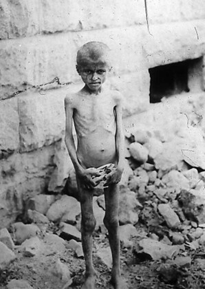 Un enfant souffrant de la faim à Erevan, 1916